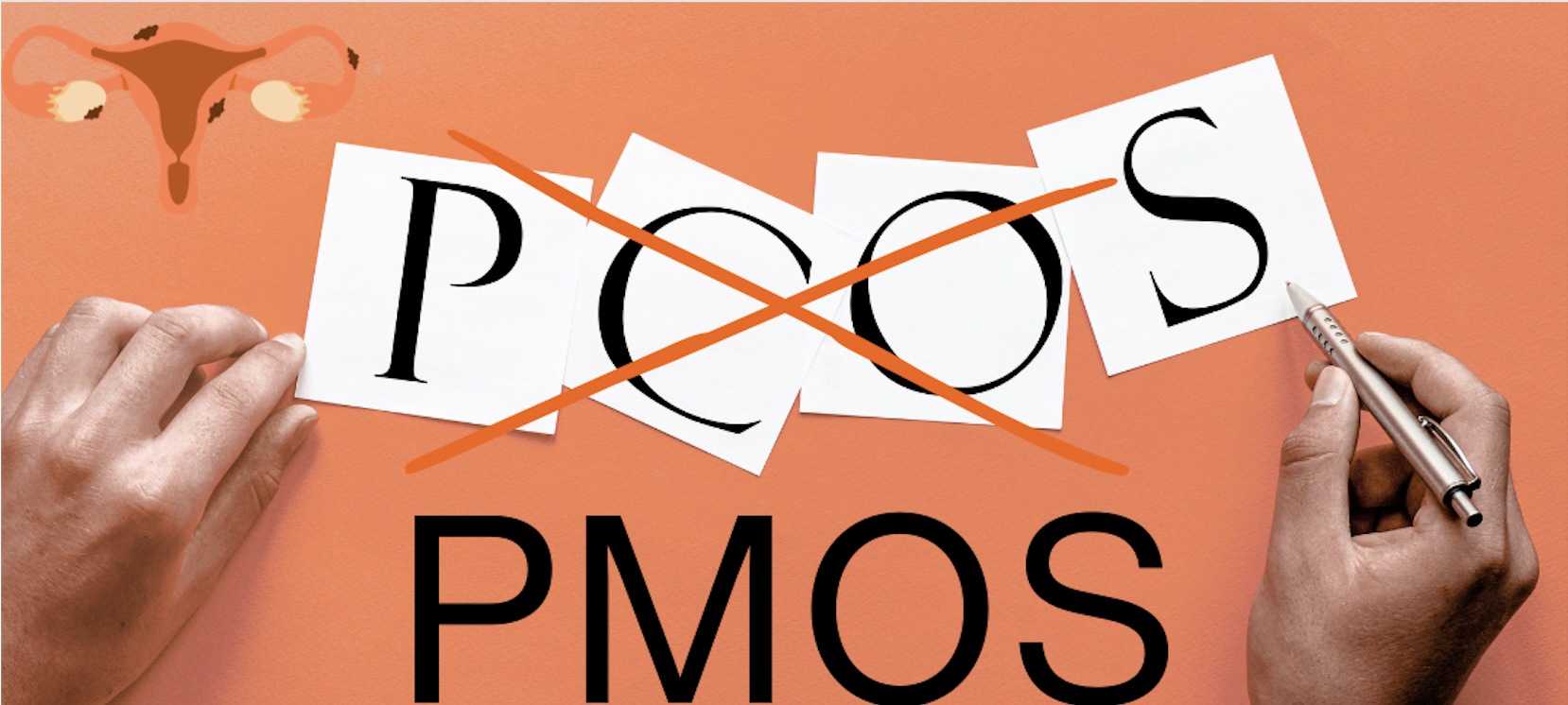 PCOS is now known as PMOS