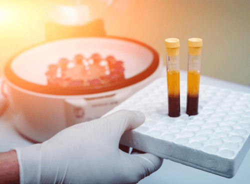Time-lapse embryo culture